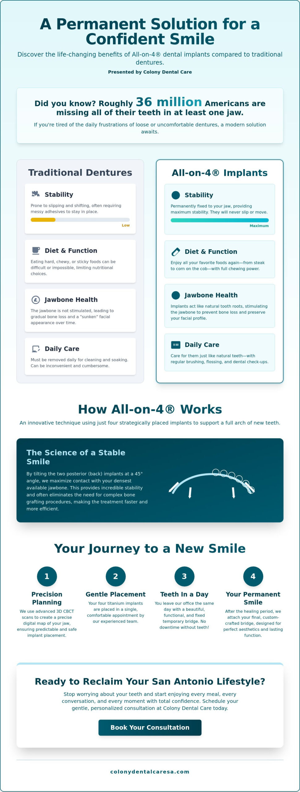 All-on-4® Dental Implants in San Antonio: Your Guide to a Permanent Smile